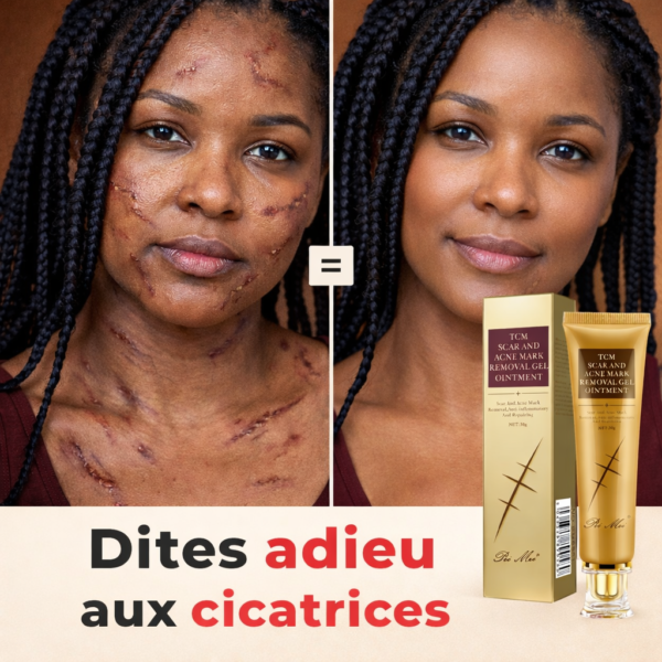 Crème Anti Cicatrice ✨ Dites Adieu aux Cicatrices !