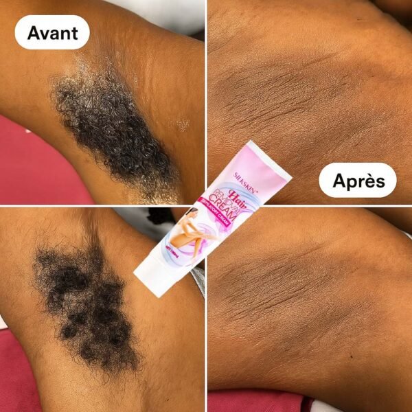 Crème Épilatoire Pour Hommes et Femmes - Soyez Toujours propres sans Poils désagréable